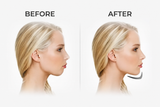 Clearance: JawSlim Nano – Facial Slimming Tool. Jawline Exerciser (Nano Design)