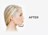 Clearance: JawSlim Nano – Facial Slimming Tool. Jawline Exerciser (Nano Design)